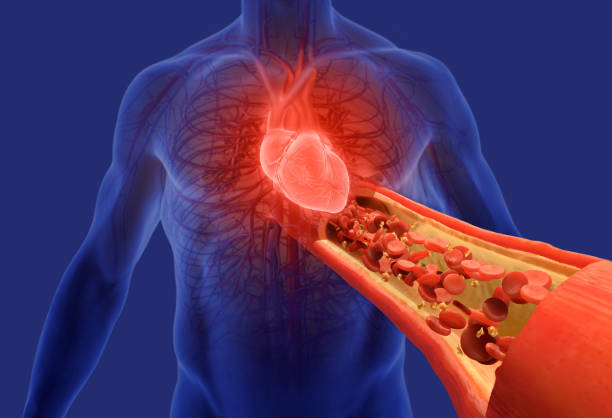 Ibyo ukeneye kumenya kuri hypertension